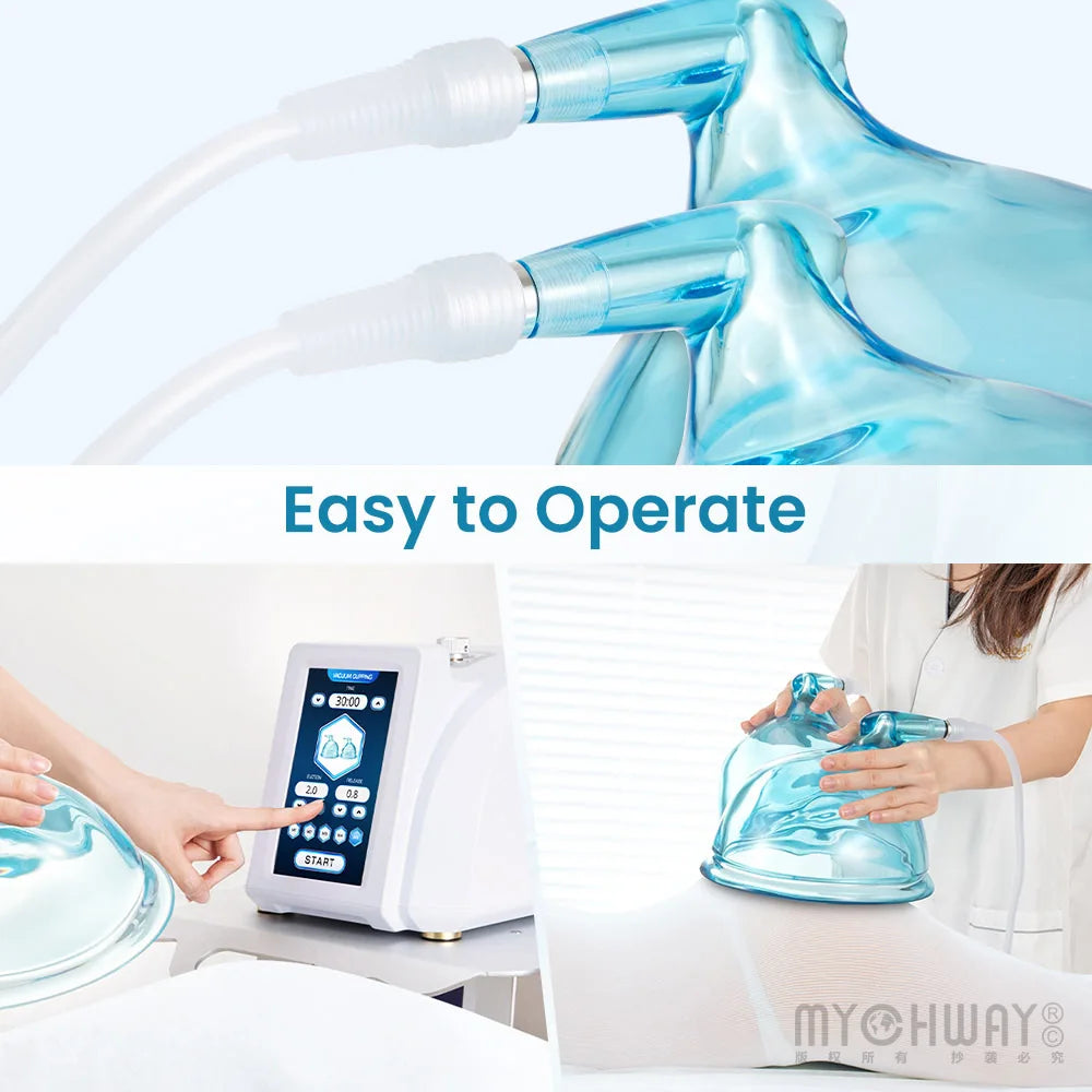 Vacuum Butt Lift Machine Strong Suction 73Kpa Larger Vacuum Cups for Beautysalon