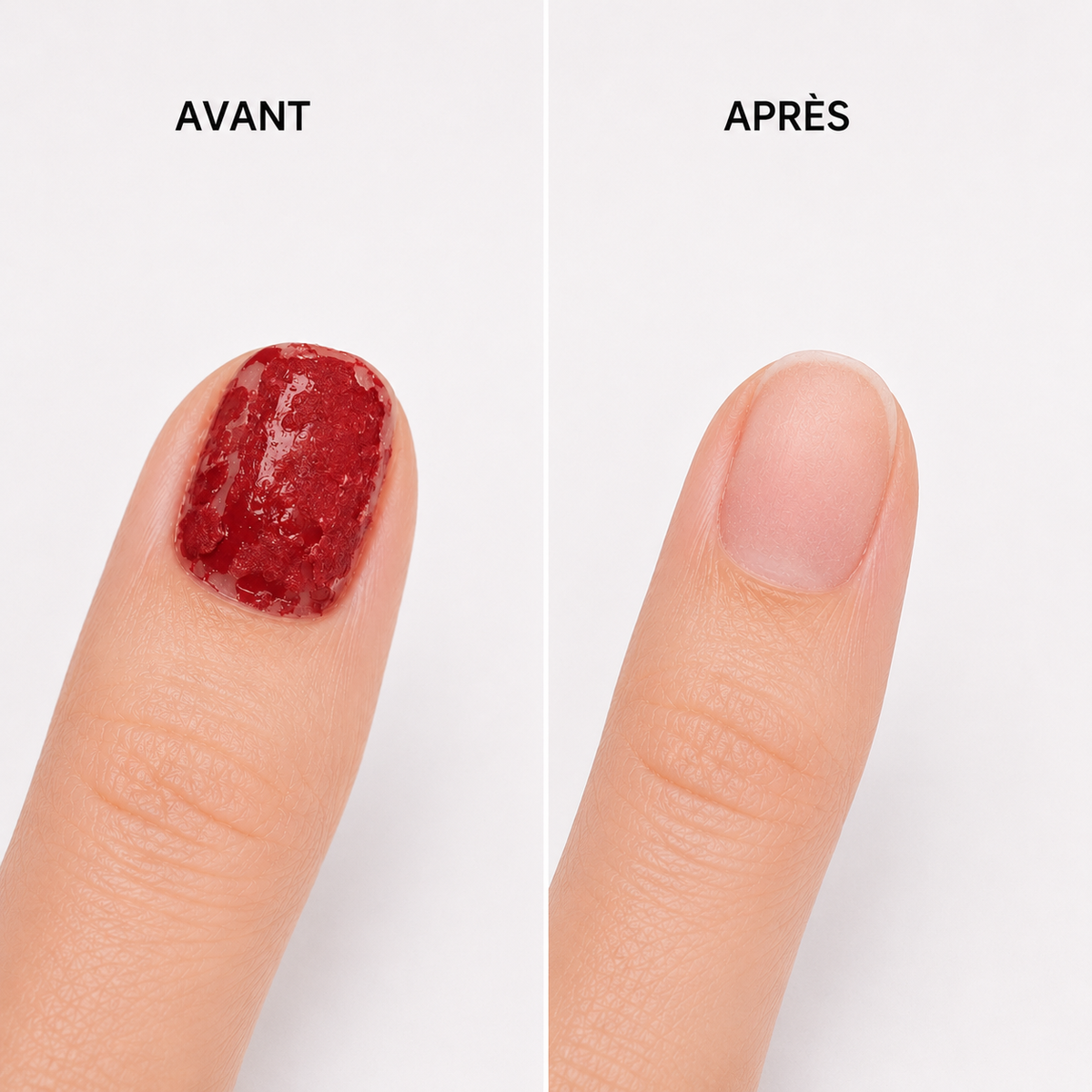 Avant/Après dépose Nail Polish Remover Vendeeni